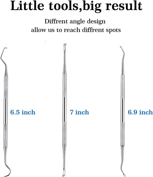 Hotop 3 Pieces Dog Dental Tooth Scaler and Scraper, Stainless Double Headed Tool for Pet Teeth Cleaning