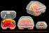 Mouth Guard Case for Most Brand Mouthpiece & Lip Guard
