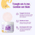 Cat Chin Acne Wipes - Feline Acne Treatment (50 Wipes), Pink