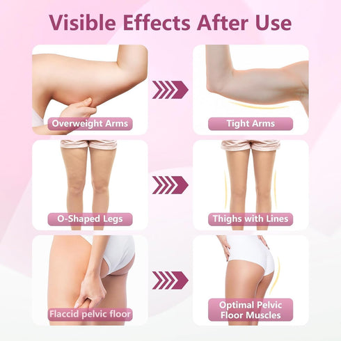 KVKVMO 360Adjustable 20LB Thigh Trainer, Pelvic Floor Muscle Trainer with LED Display, Inner Thigh Exerciser