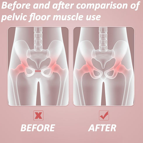 Mireva Fit Counter Pelvic and Thigh Trainer | Women's Pelvic Floor Exercise Devices Trainer | Kegel Exerciser, Thigh