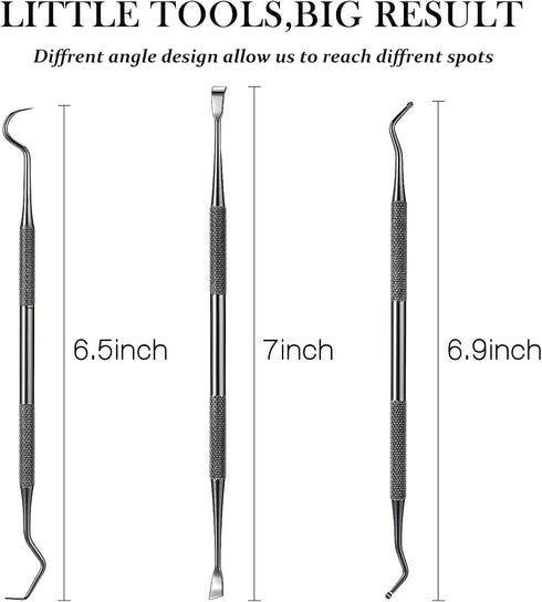Hotop 3 Pieces Dog Dental Tooth Scaler and Scraper, Stainless Tools for Pet Teeth Cleaning