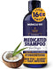 Miracle Vet Medicated Dog Shampoo for Itchy Skin Relief - Antifungal for