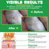 ZIXBMHYJ 2 Pack Lipoma Treatment for Dogs & Cats, Castor Oil for Lipomas, Soften Fatty Lumps & Bumps in Dog, Castor Oil