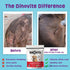Dinovite Probiotic Supplement for Dogs, Omega 3 for Hot Spot Relief, Skin & Coat Supplement, 30 Day Supply for Large