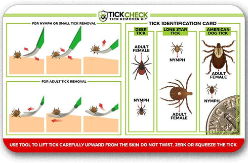 TickCheck Premium Tick Remover Kit, Stainless Steel Tick Remover + Tweezers, Leather Case, Pocket Tick Identification