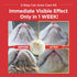 3-Step Chin(1EA) Wipes(30PCS) Brush(1EA) JAYU PET Cat Acne Care Kit - Hypoallergenic Cleanser for Feline Acne, Cat