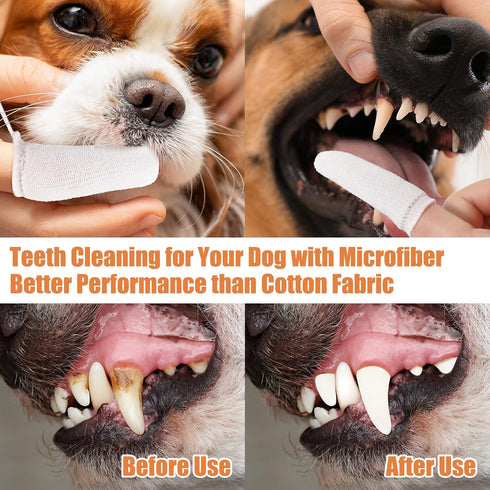 20 Pcs Soft Microfiber Fingerbrush for Dogs, Pet Dental Finger Brush for Dog Cat Teeth Cleaning