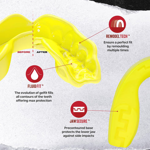 SAFEJAWZ Sports Mouthguard Slim Fit, Adult and Junior Mouth Guard with Case for Contact Sports, Yellow