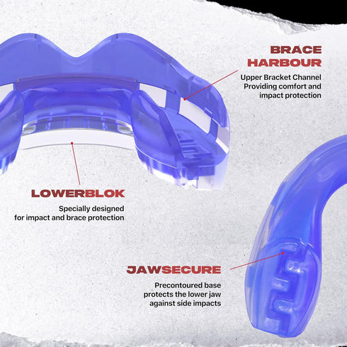 SafeJawz Mouthguard for Braces - One Size Re-Mouldable Mouth Guard with Case for Boxing, Basketball, Football, MMA,